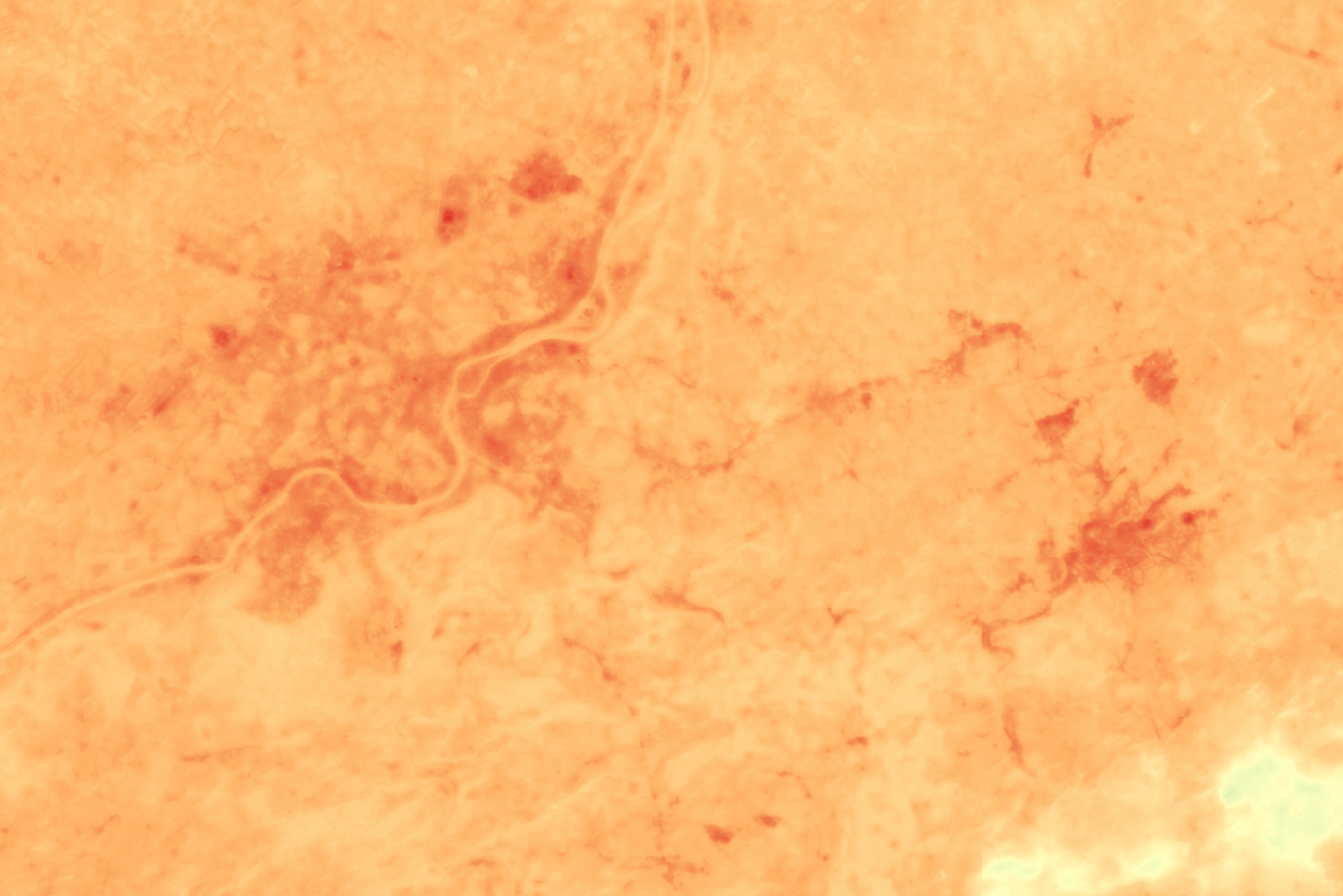 Senwise high def by TeleCense